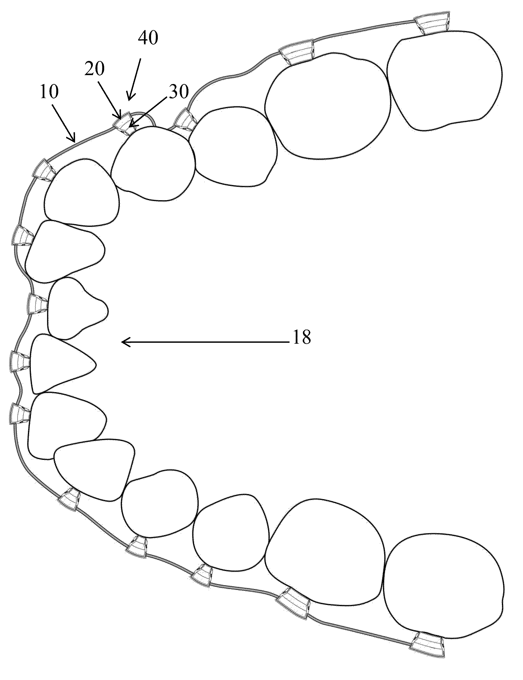 Orthodontic appliance