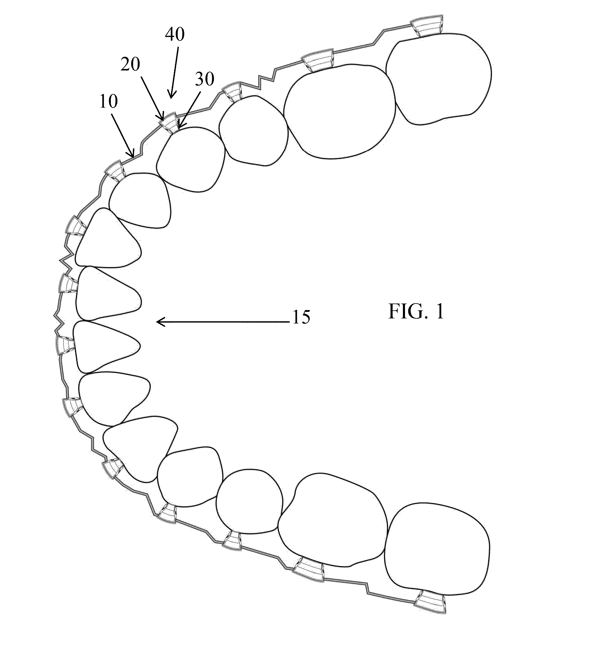 Orthodontic appliance