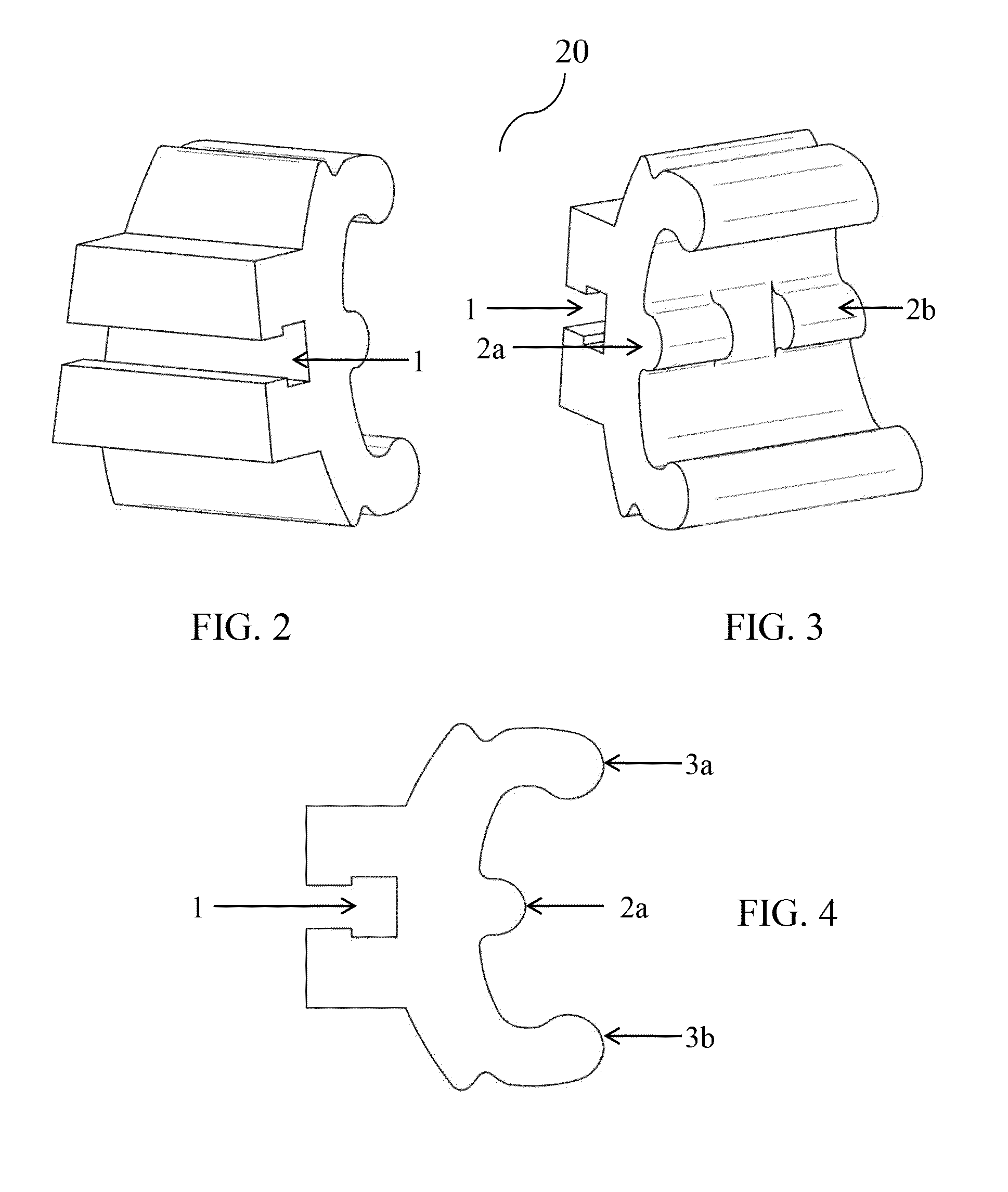 Orthodontic appliance