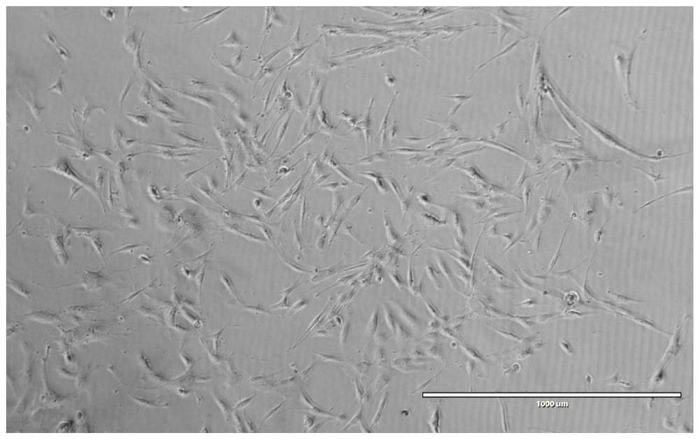 A method for isolating, culturing and neurally directed differentiation of dental pulp stem cells from deciduous teeth