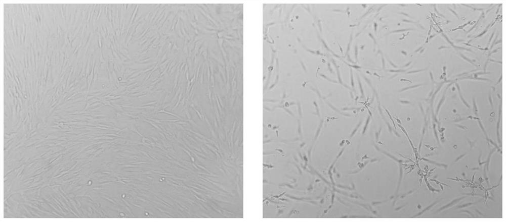 A method for isolating, culturing and neurally directed differentiation of dental pulp stem cells from deciduous teeth