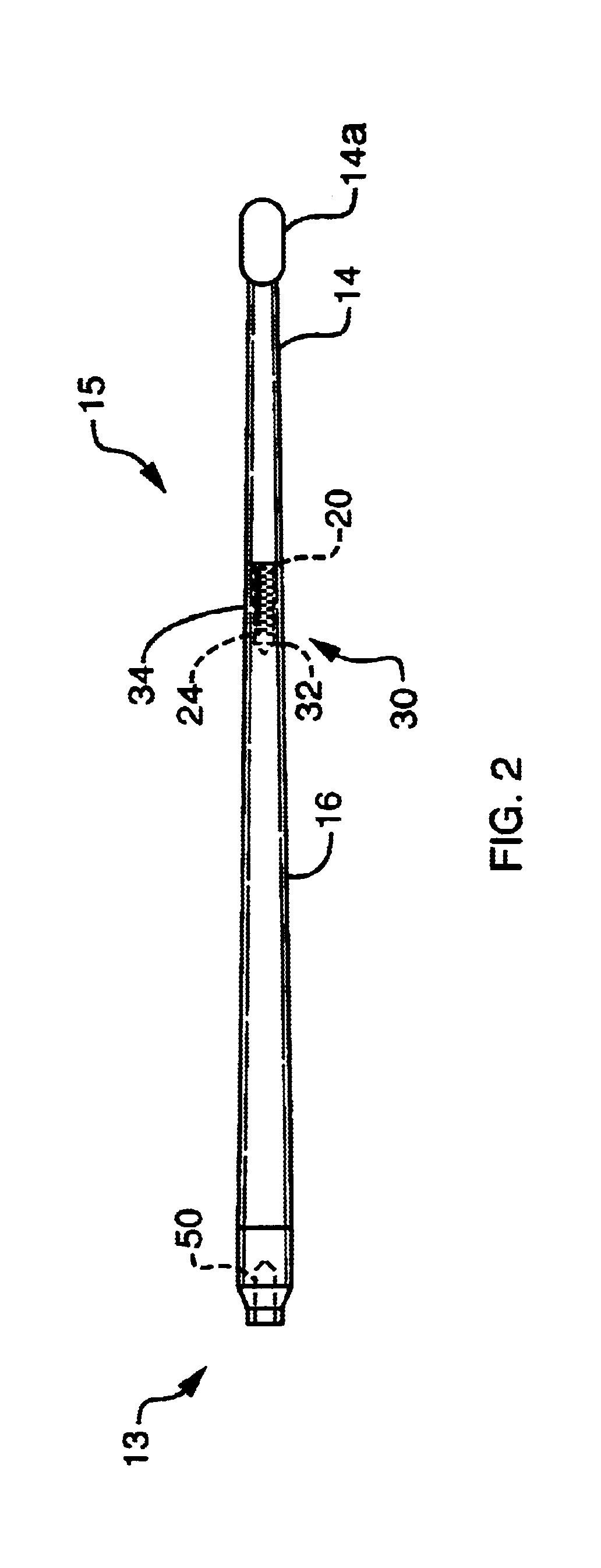 Curette with detachable tip