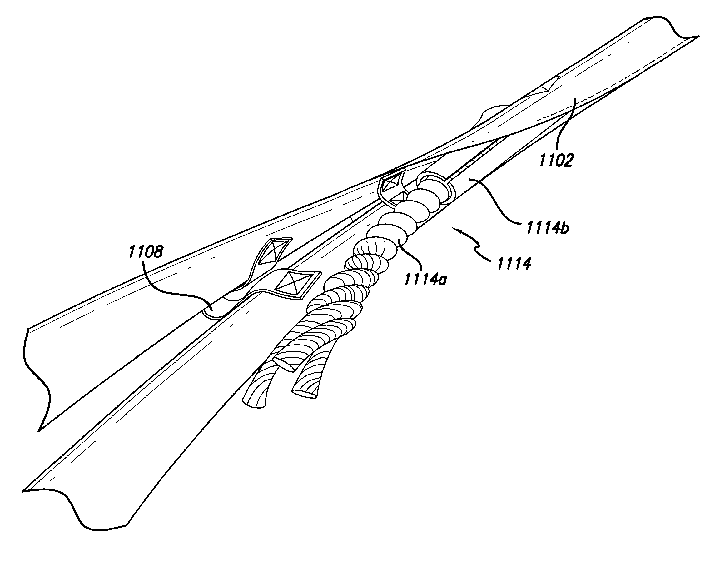 Exercise apparatus