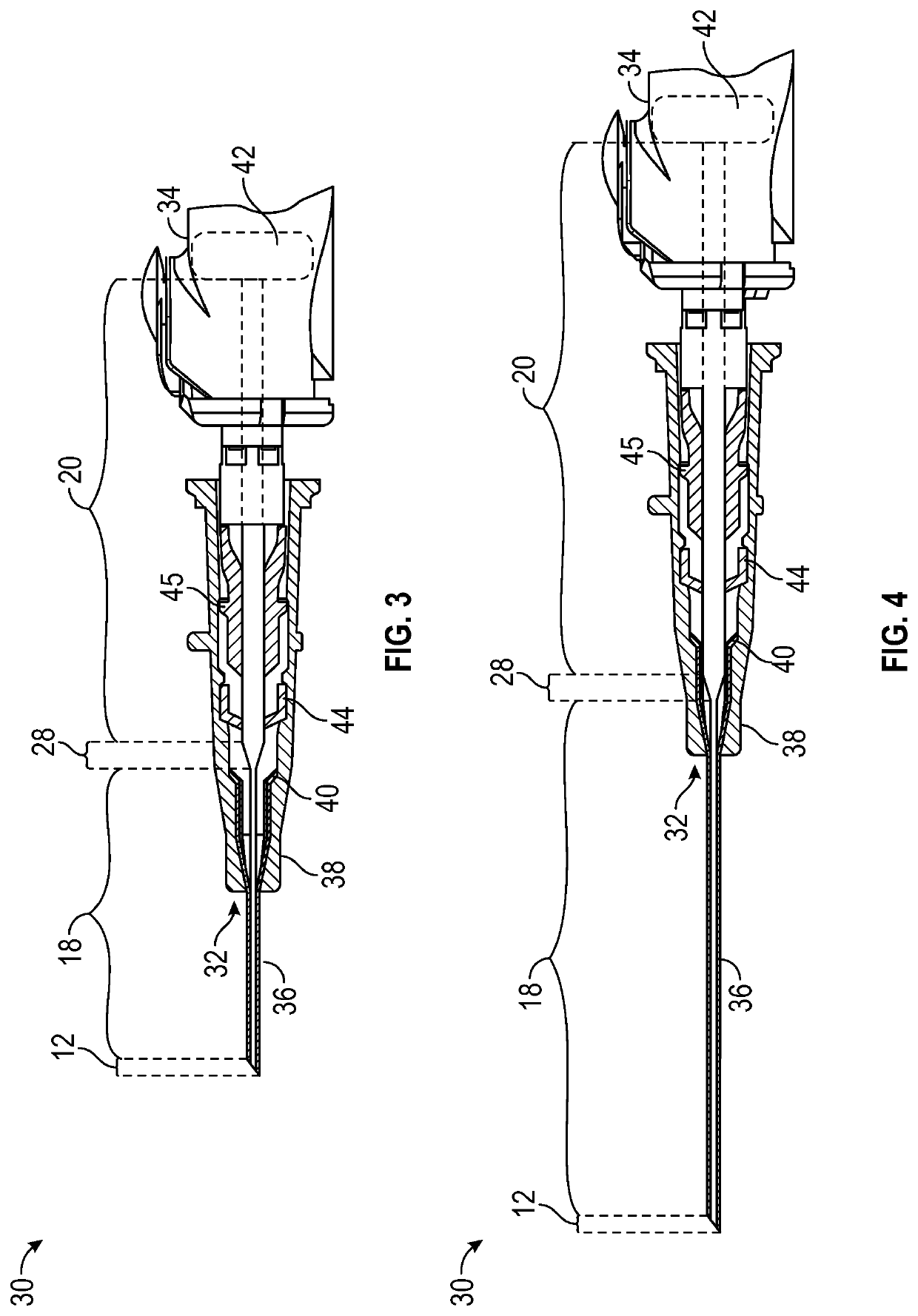 Multi-diameter cannula