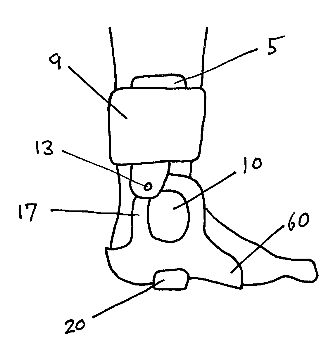 Articulated ankle foot brace having a malleolar window