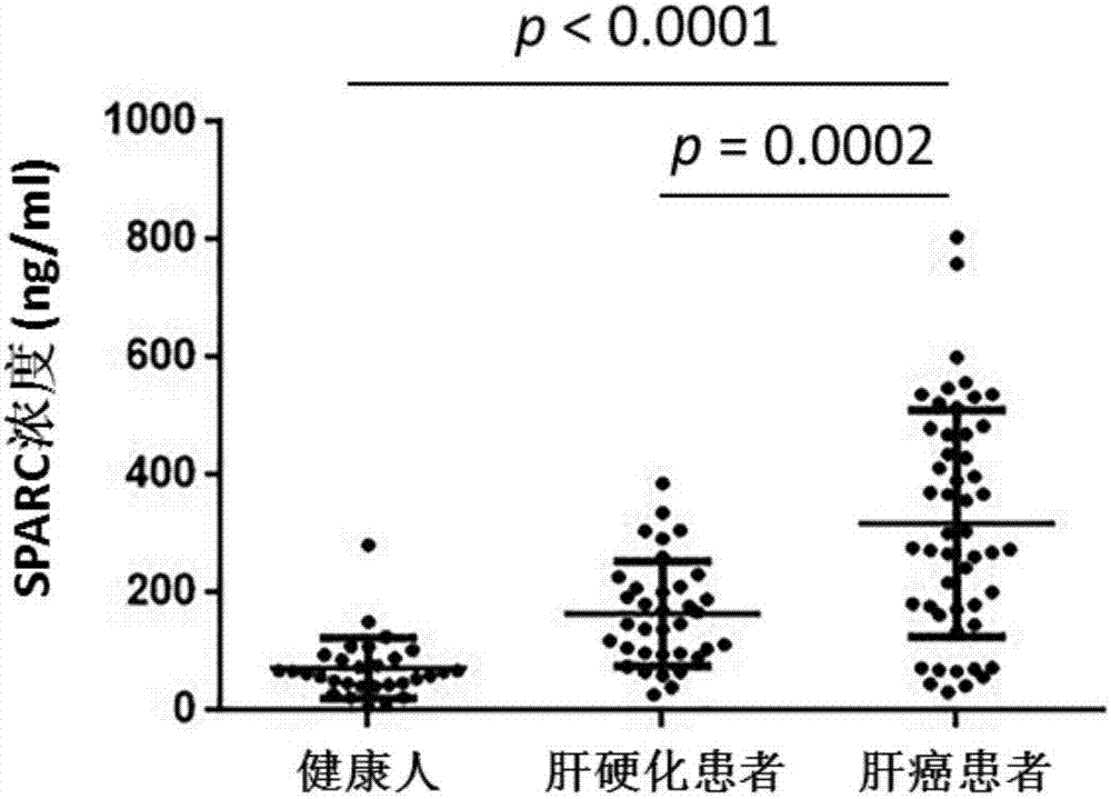 Application of substances for detecting sparc protein in serum in preparation of kits for screening hepatocellular carcinoma