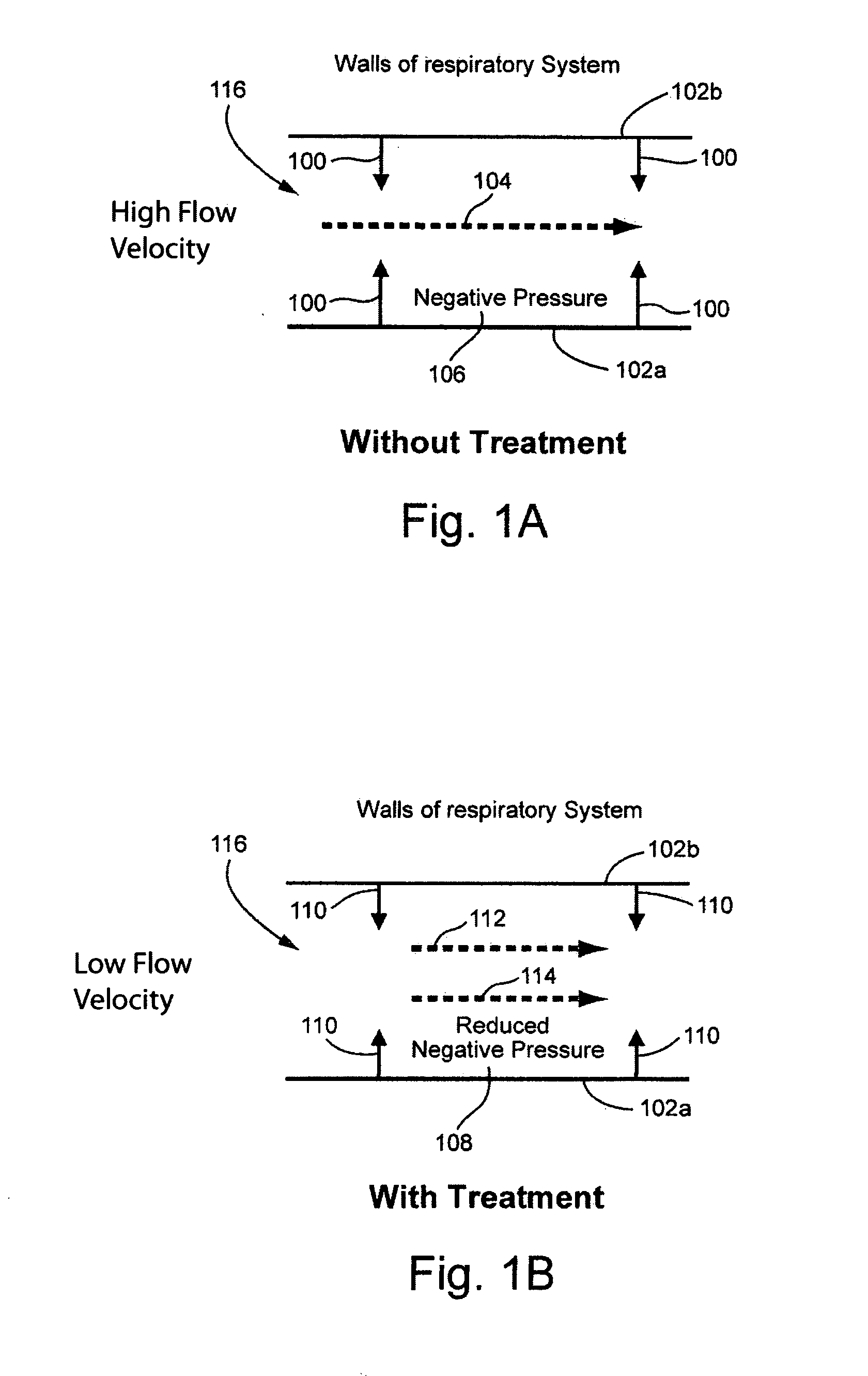 Respiratory resistance systems and methods