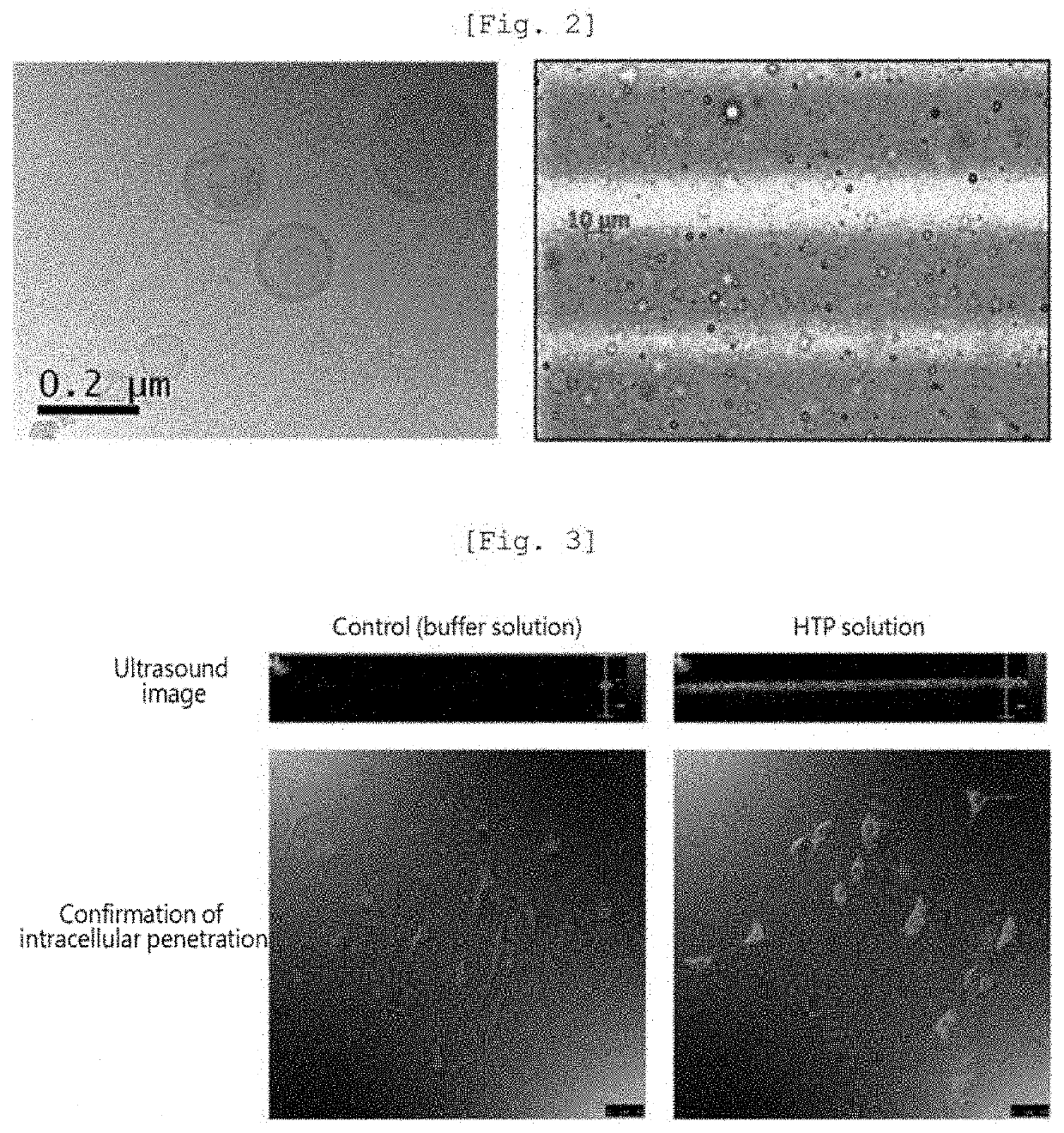 Nanoliposome-microbubble conjugate including drug for hair loss treatment encapsulated in nanoliposome and composition for alleviating or treating hair loss containing same