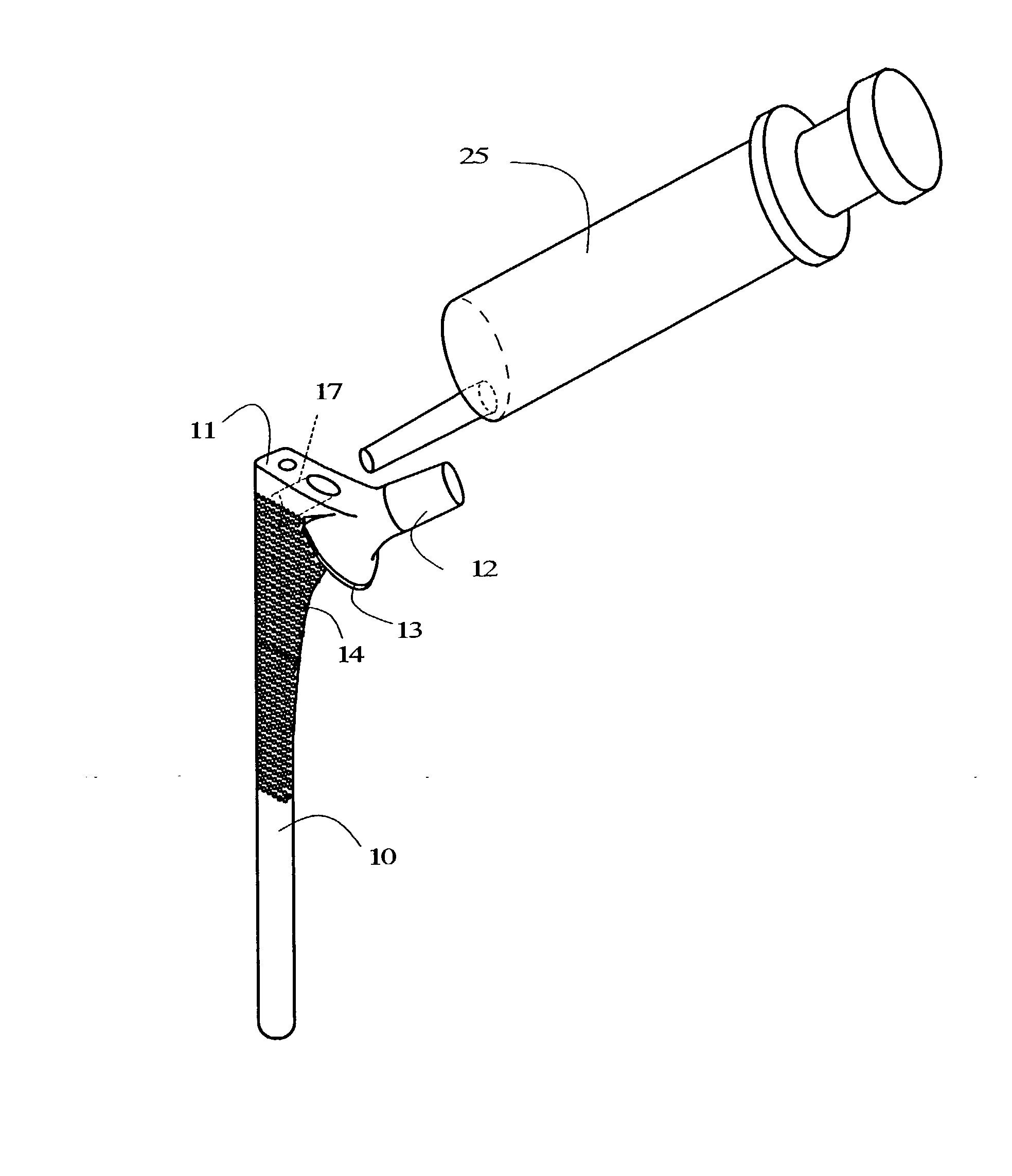 Stem of artificial hip joint