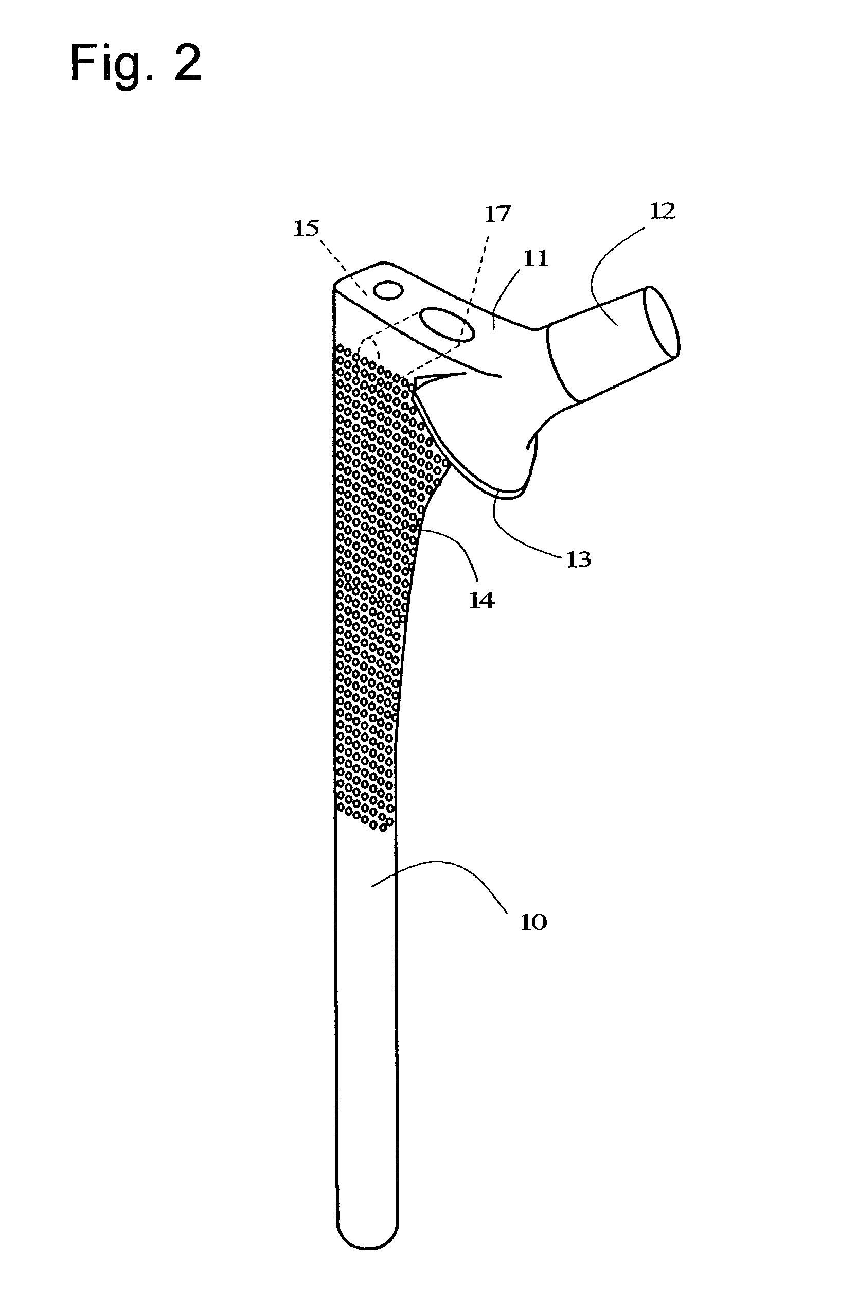 Stem of artificial hip joint