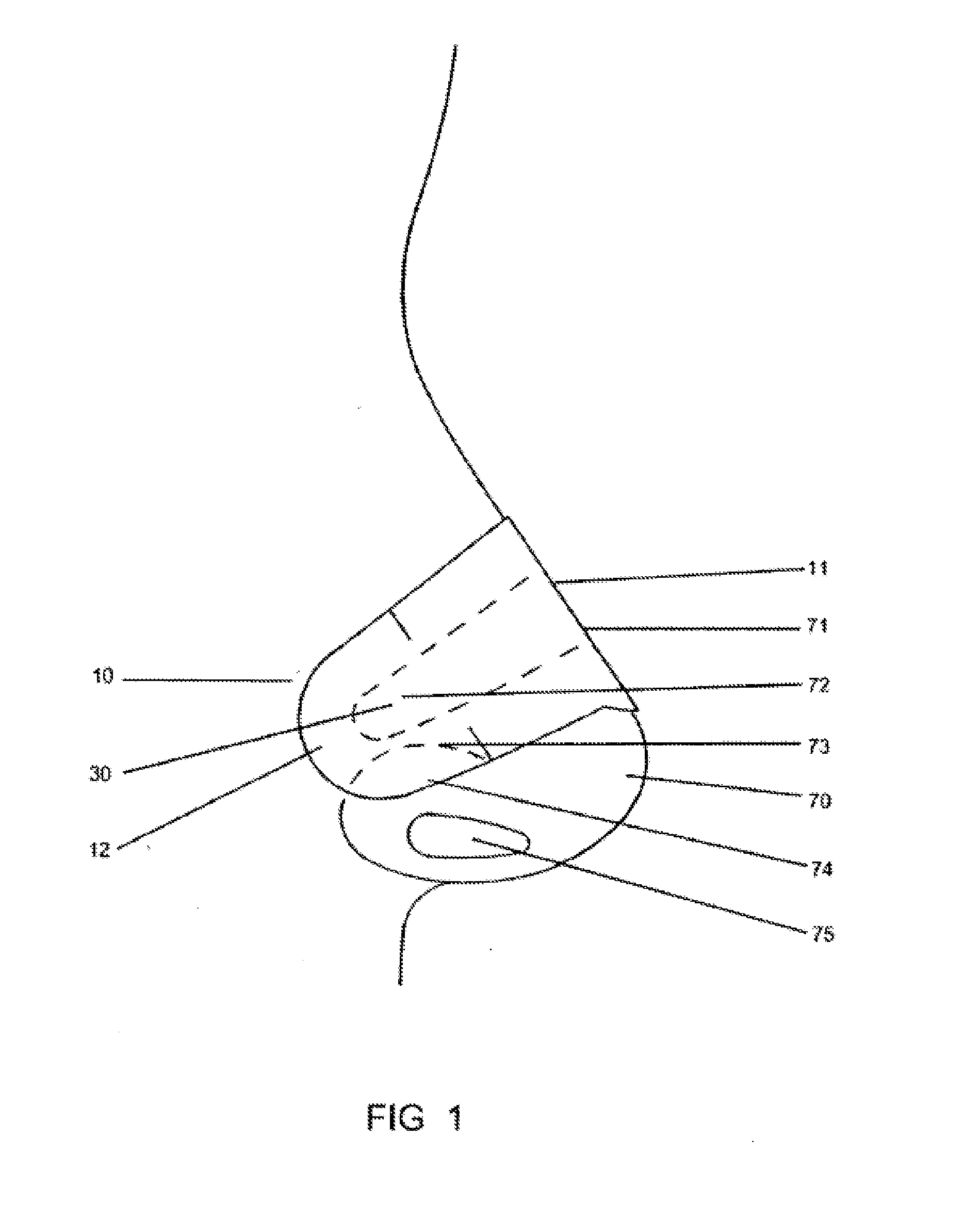 Nasal dilator with variable spring rate