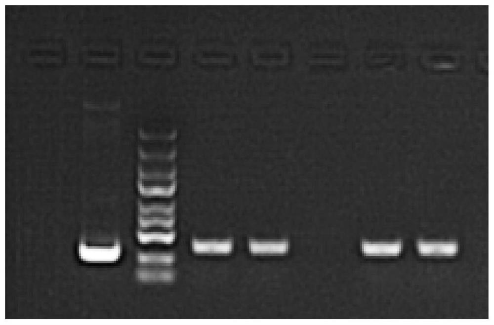 Application of human DSN1 gene and related products