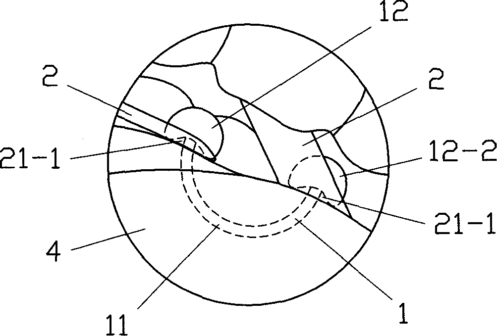 Elastic tongue dorsum traction apparatus and method for implanting same