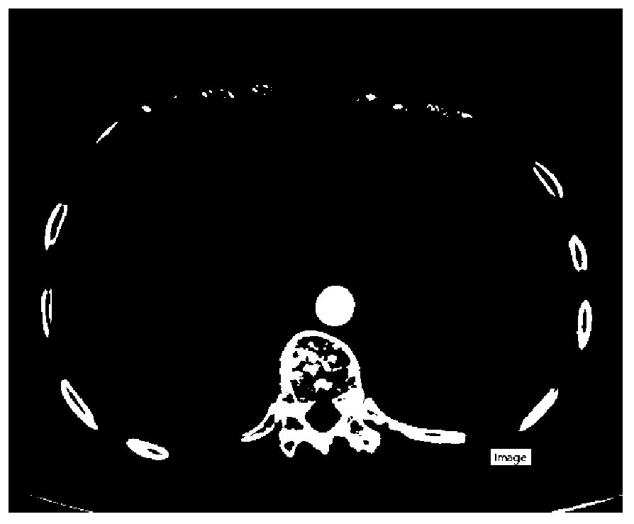 Liver tumor automatic segmentation positioning method and system and storage medium