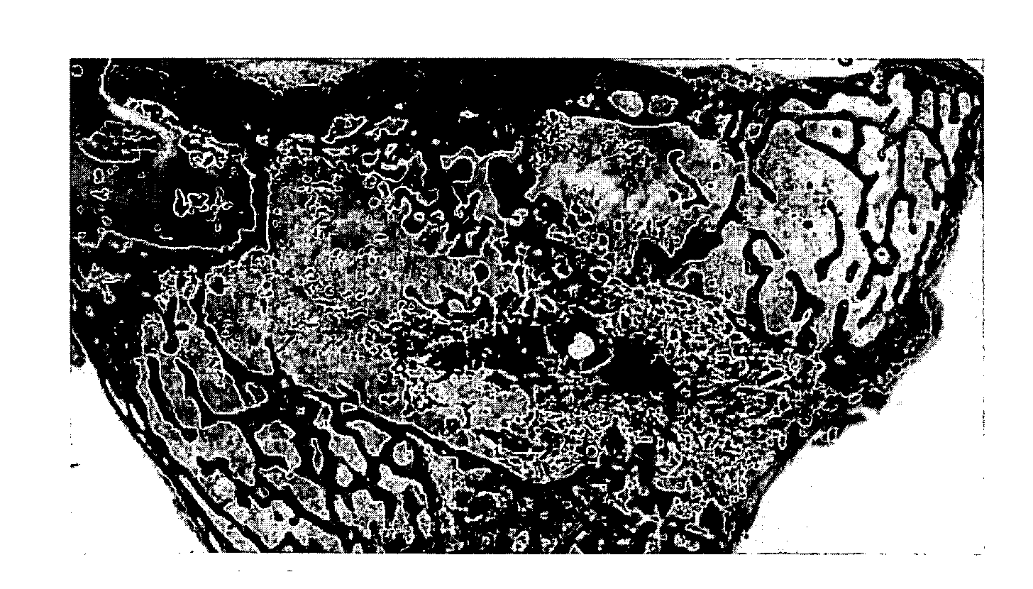 Fibrin Compositions Containing Strontium Compounds