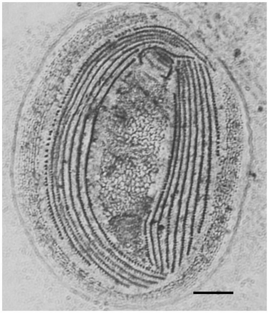 A Rapid Preparation Method of Dry Silver Stained Samples of Freshwater Ciliates