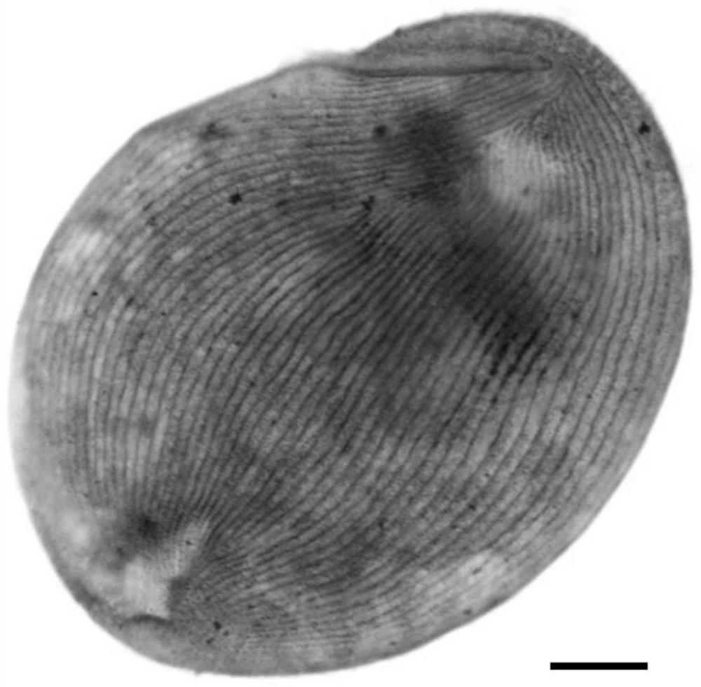 A Rapid Preparation Method of Dry Silver Stained Samples of Freshwater Ciliates