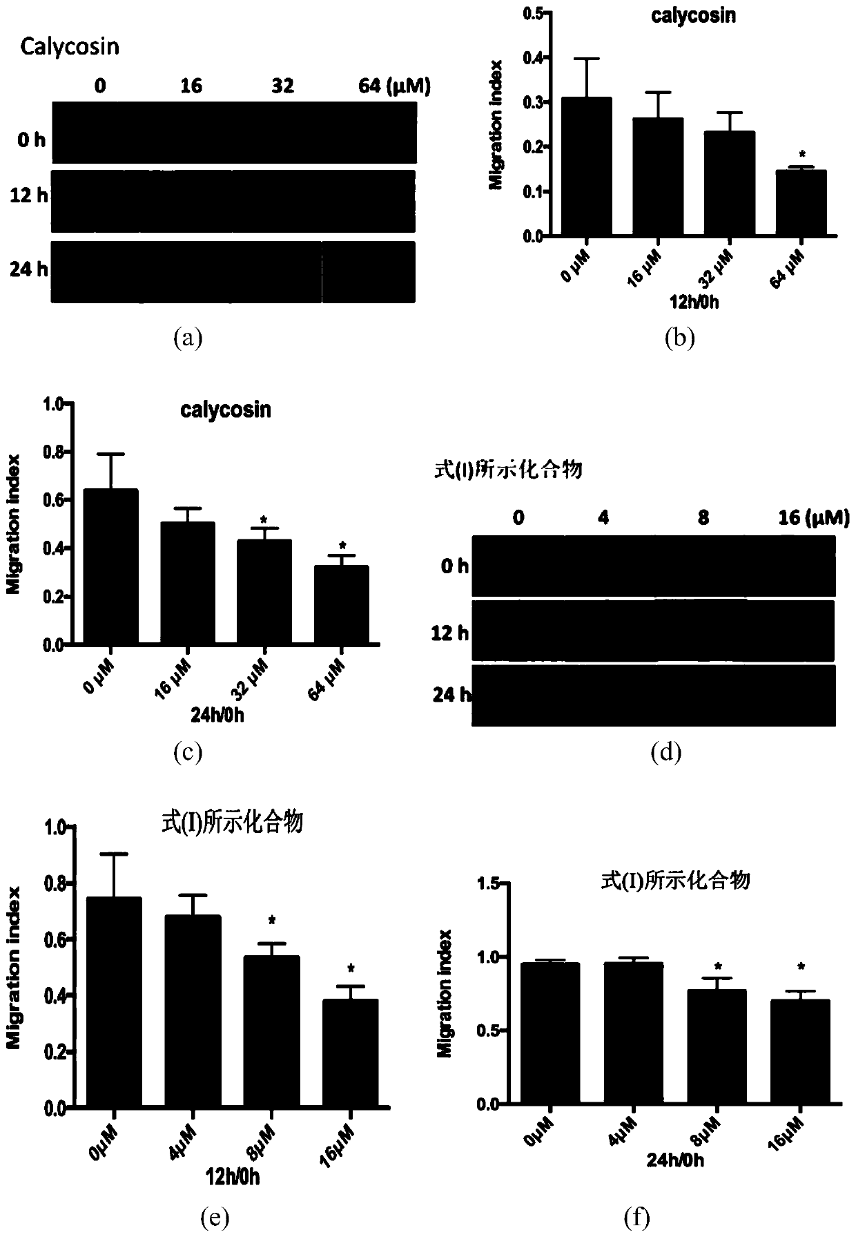 Application of calycosin derivative to preparation of medicines for restraining proliferation of endothelial cells