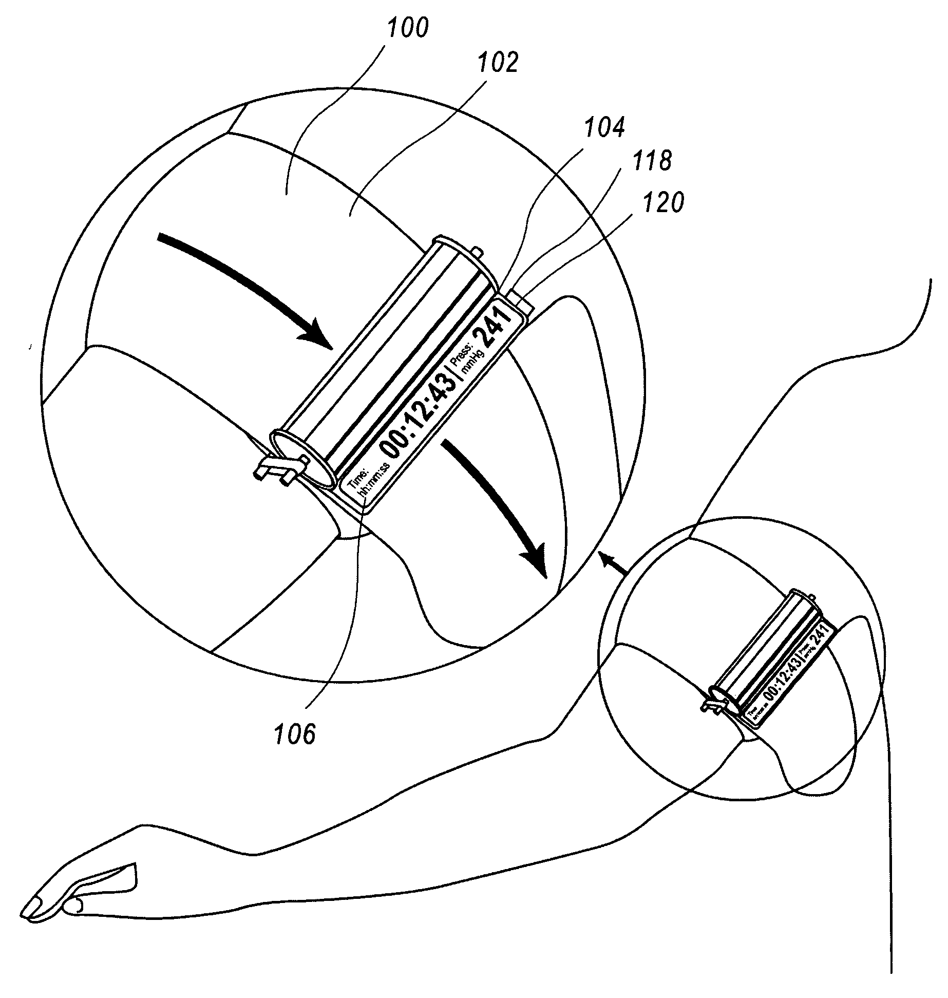 Tourniquet timer