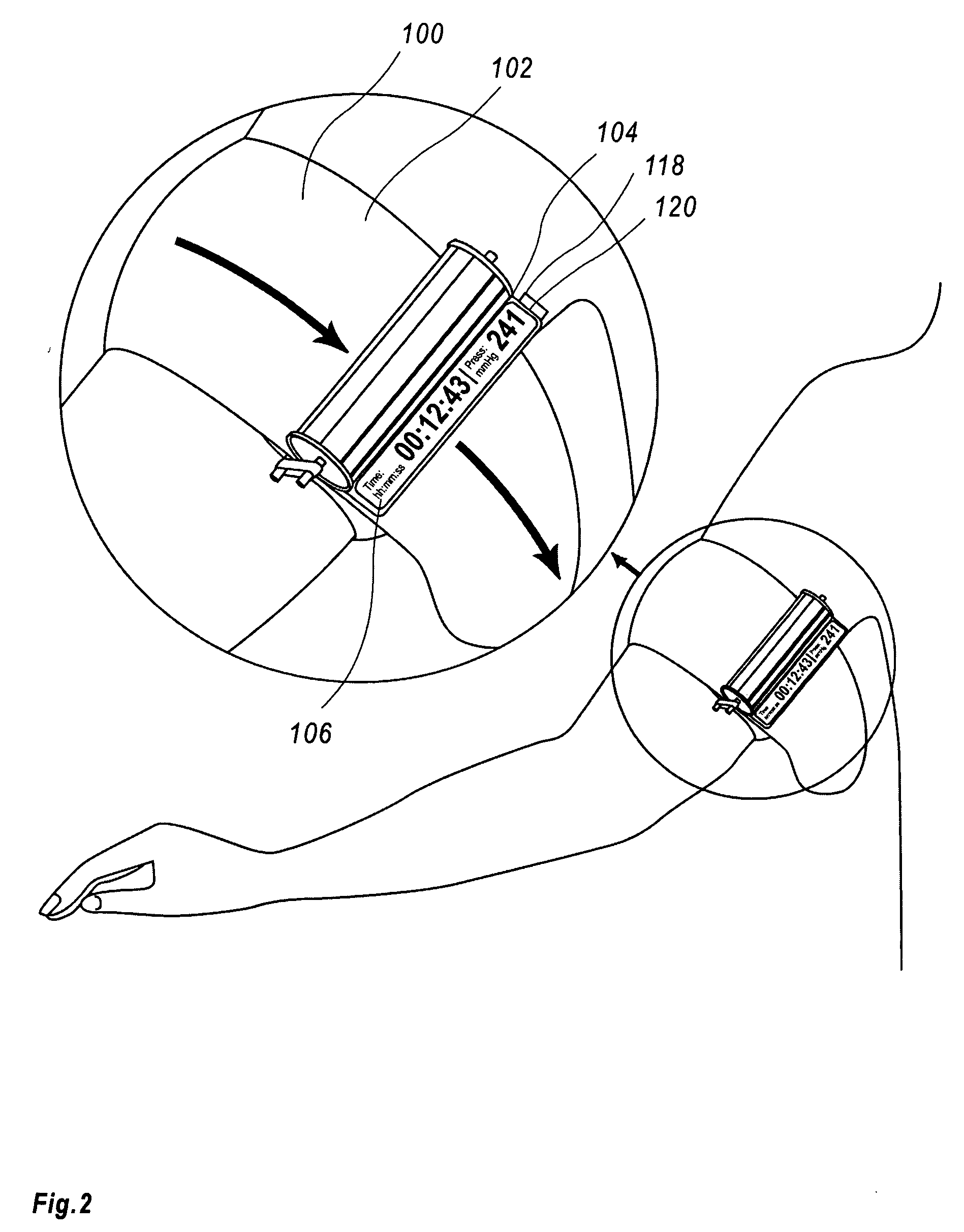 Tourniquet timer