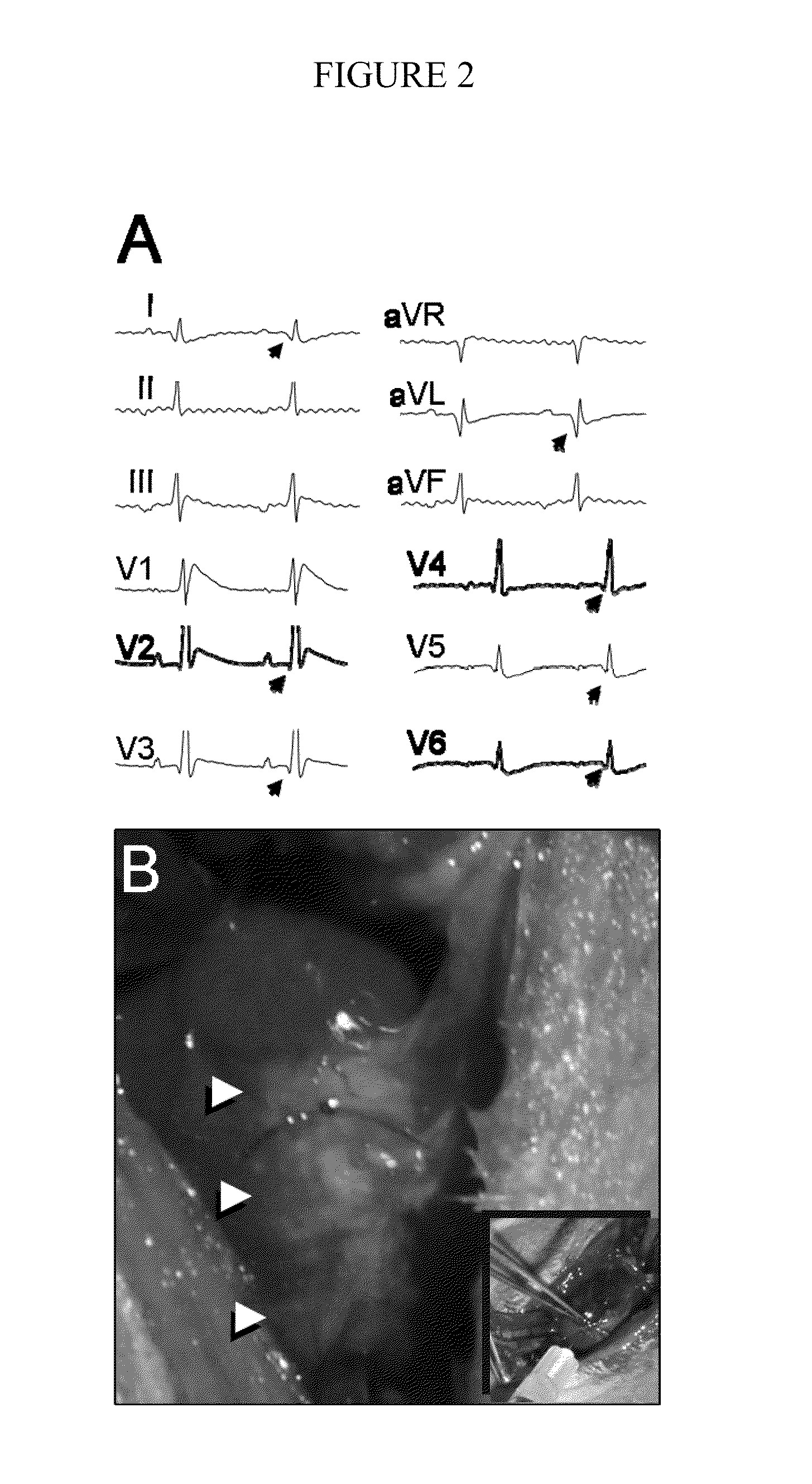 Compositions consisting essentially of TGF-β, BMP-2 FGF-4, leukemia inhibitory factor, IGF-1, IL-6 and H-α-thrombin