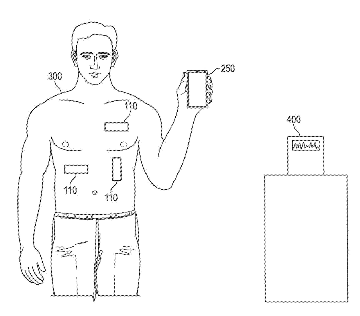 Wireless ECG sensor system and method