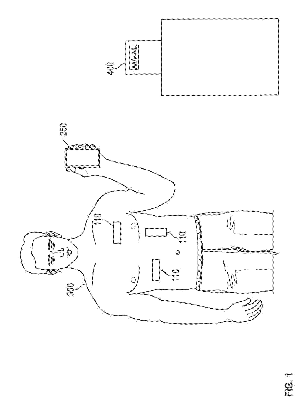 Wireless ECG sensor system and method