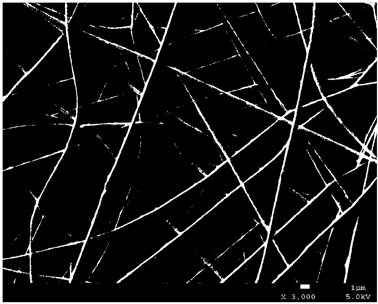 Novel dual-layer composite bone tissue engineering scaffold and preparation method thereof