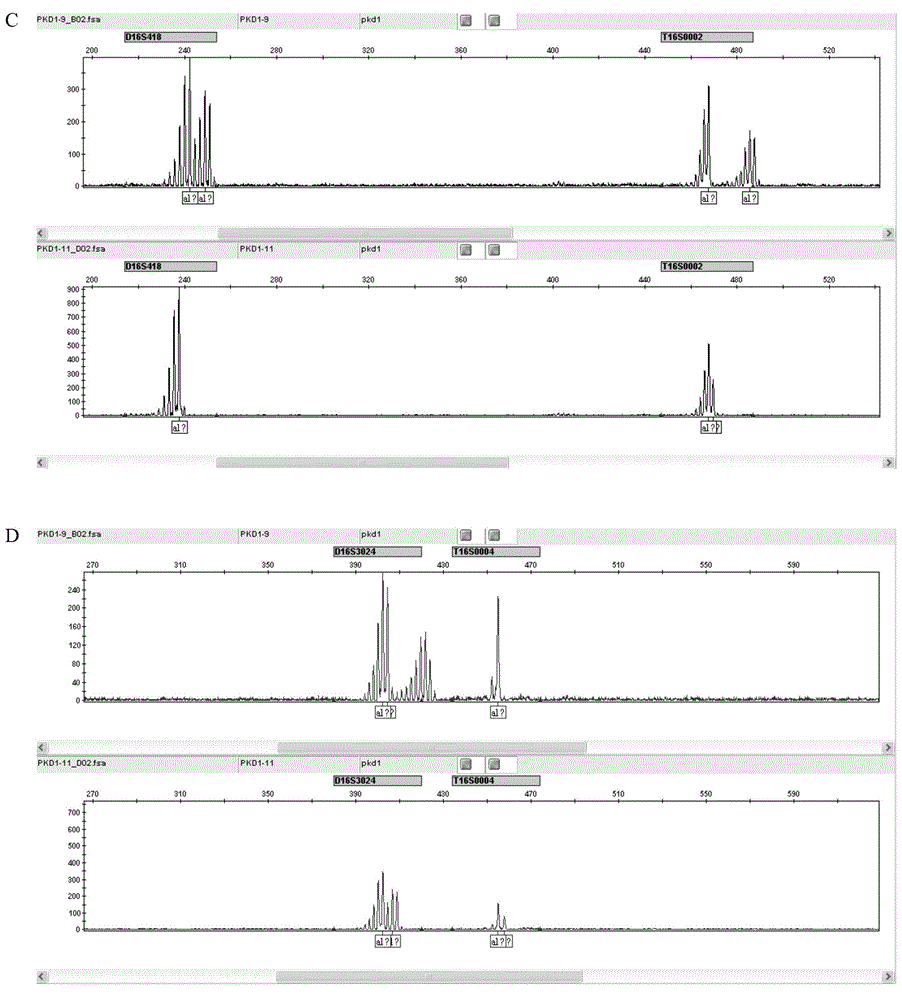 STR locus of PKD1 gene and application thereof