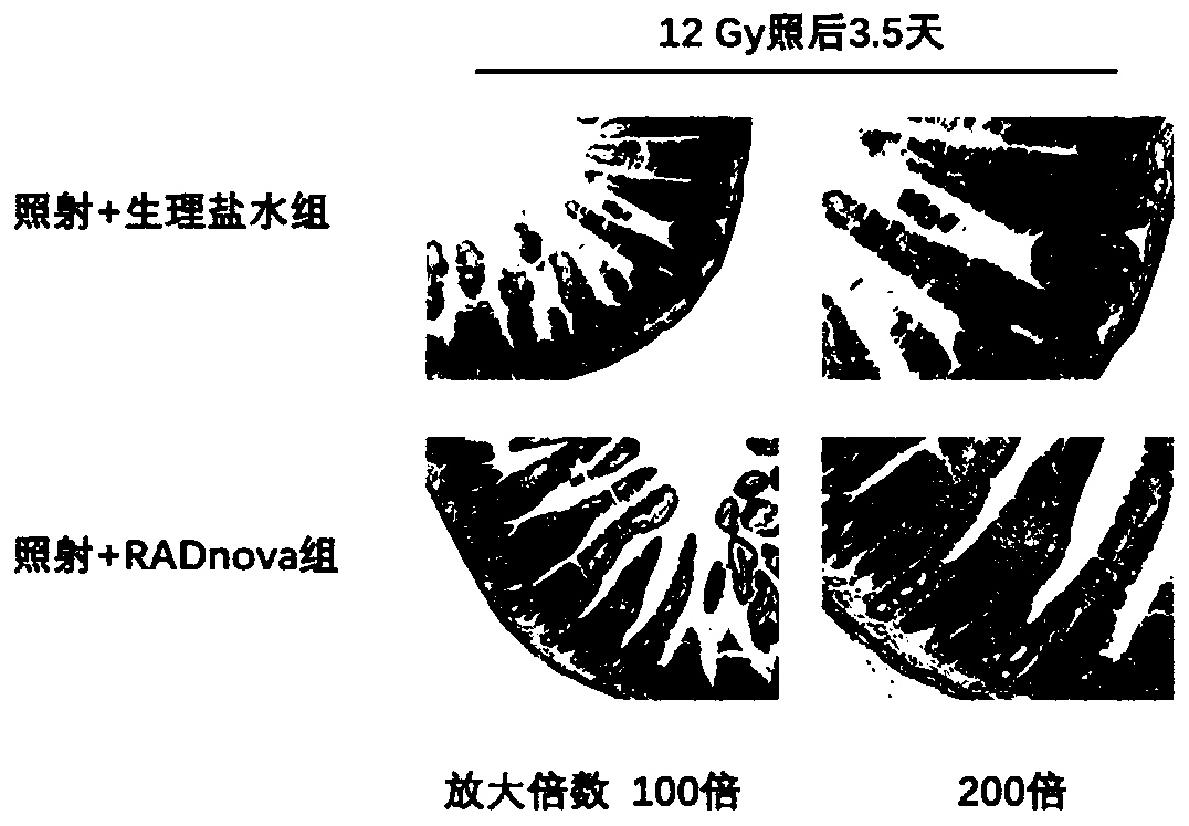 Application of compound in RADNOVA anti-radiation treatment