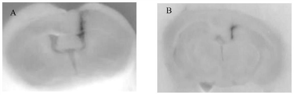 Construction method of corpus callosum cut-off animal model