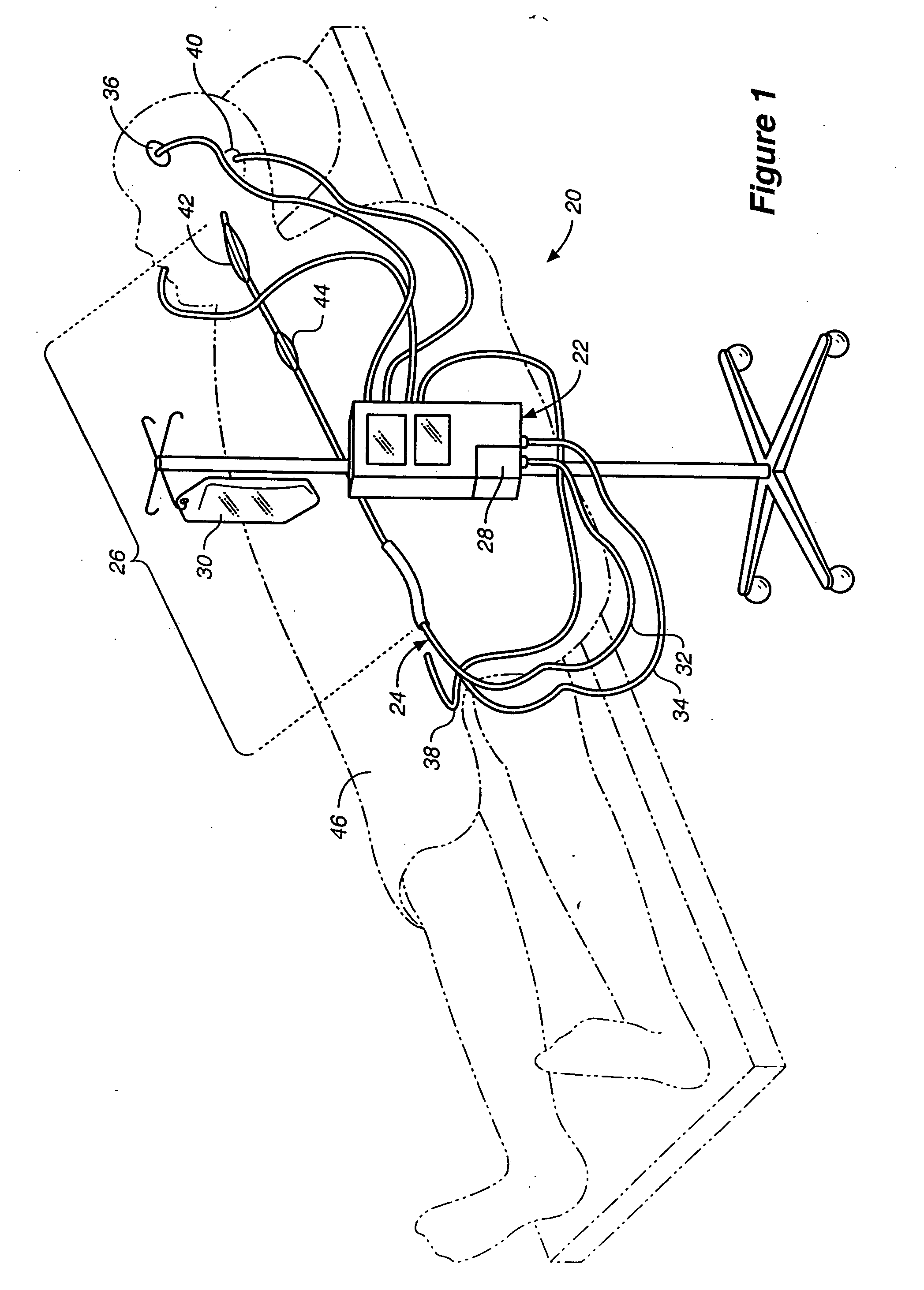 Method and system for control of a patient's body temperature by way of a transluminally insertable heat exchange catheter