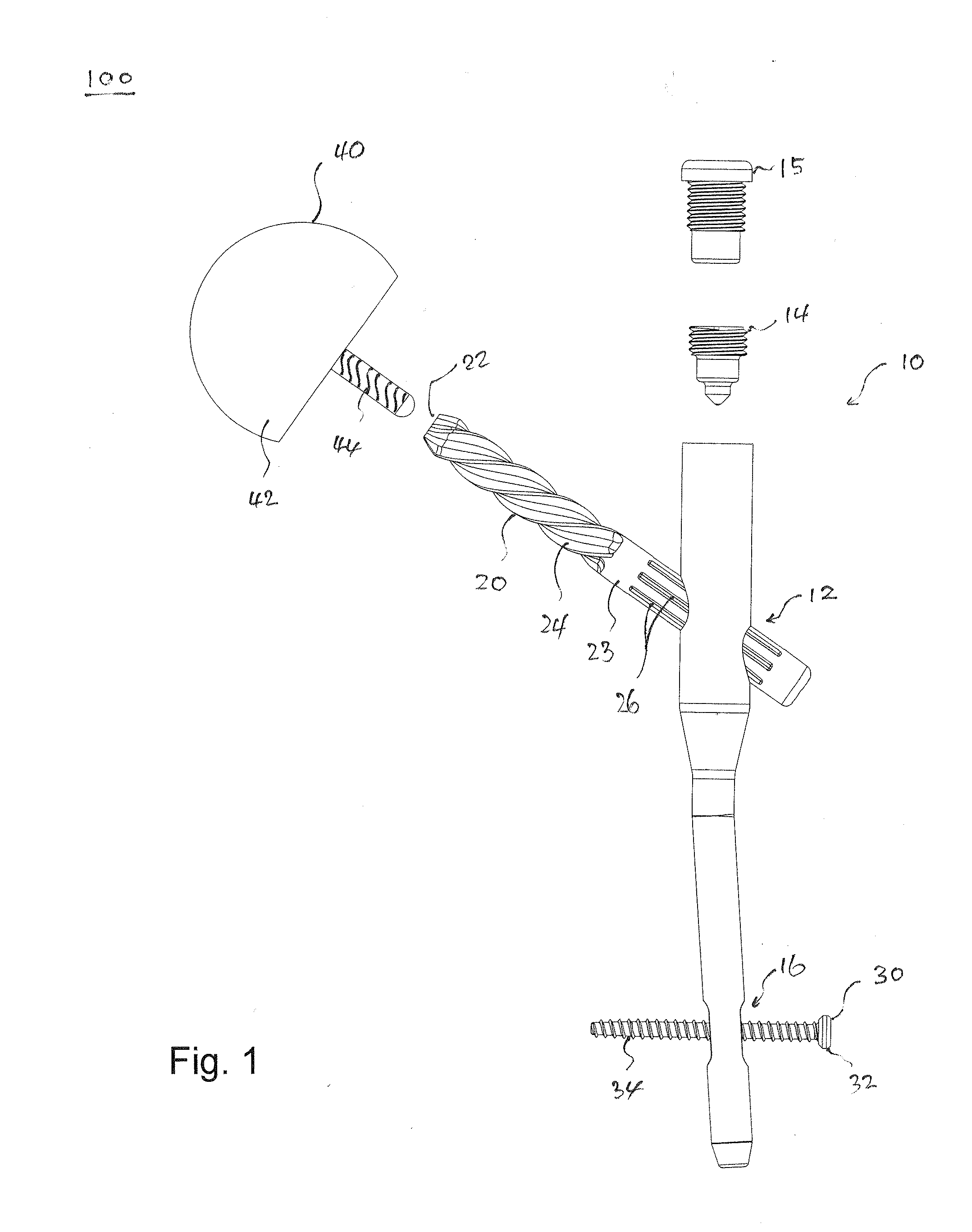 Minimal Invasive Hip Arthroplasty Device