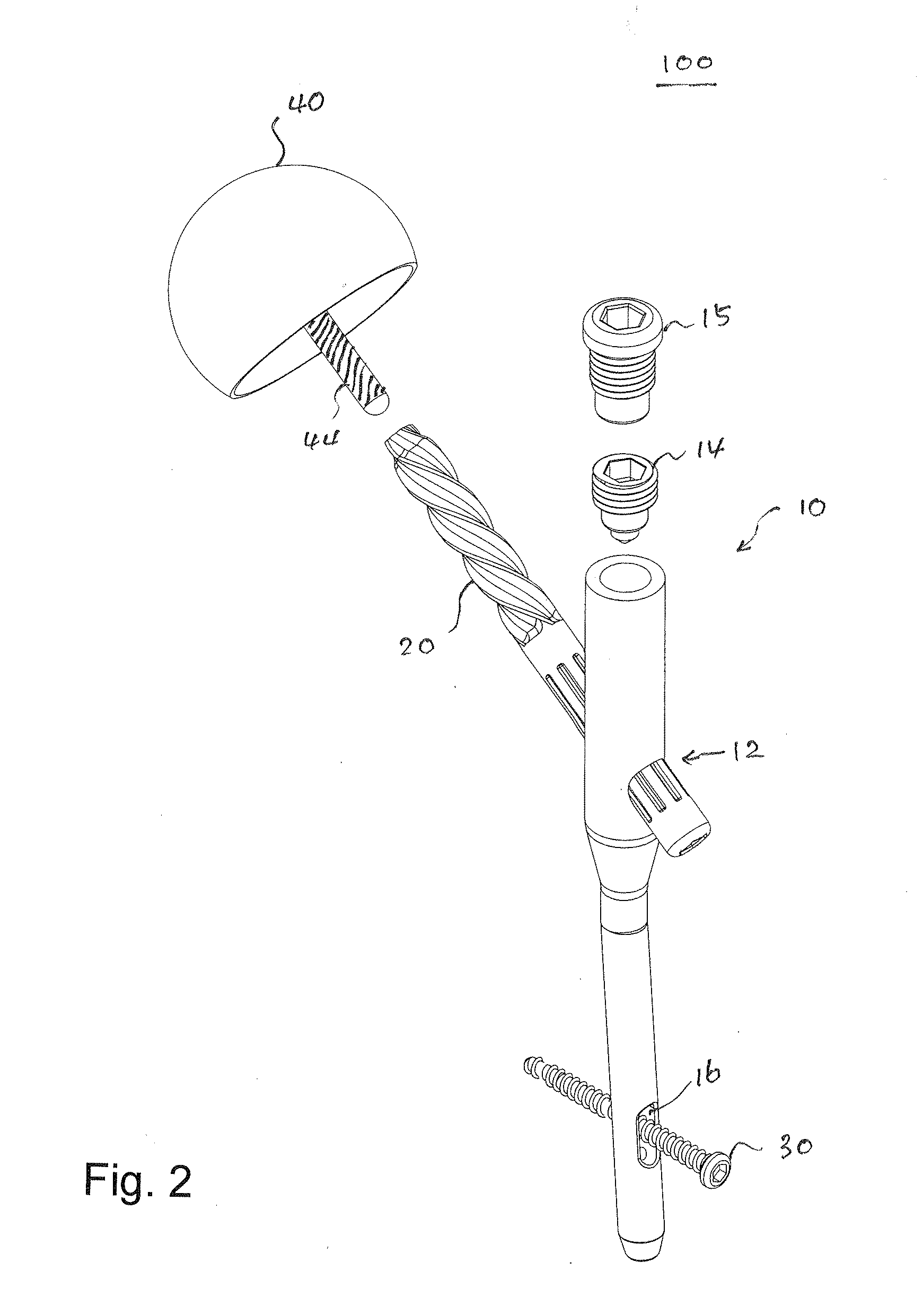 Minimal Invasive Hip Arthroplasty Device