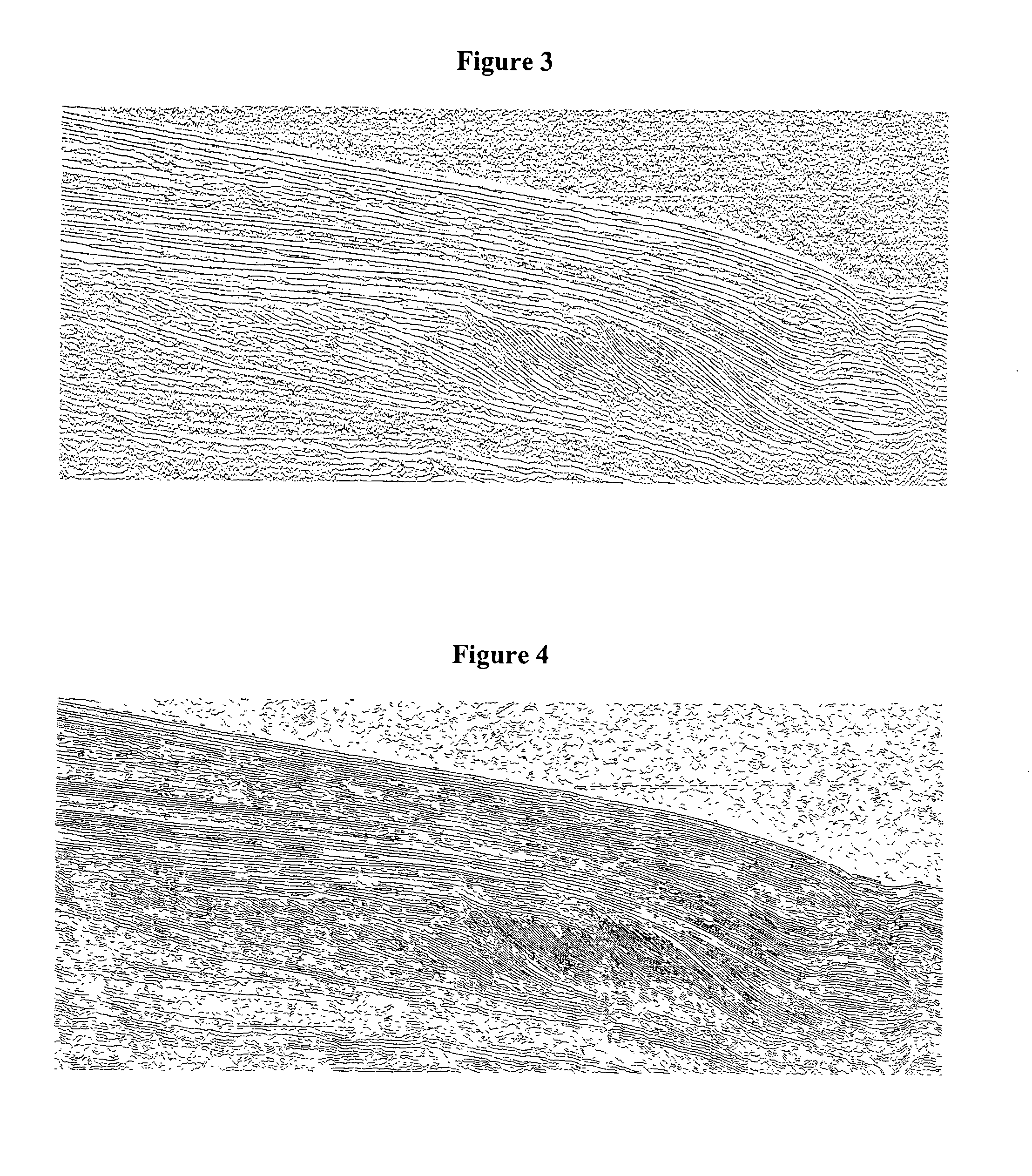 Method of sedimentologic interpretation by estimation of various chronological scenarios of sedimentary layers deposition