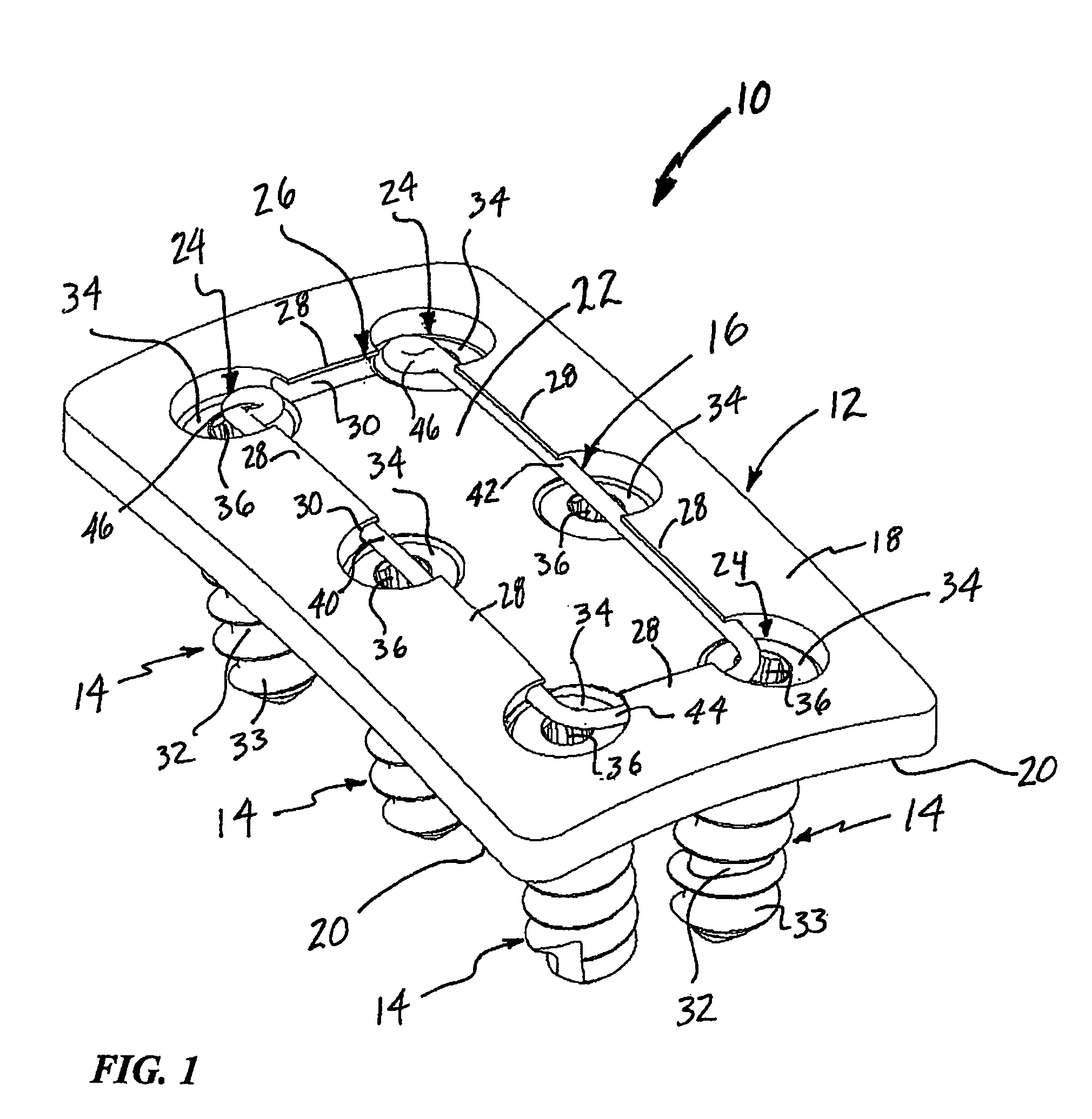 Surgical fixation system and related methods