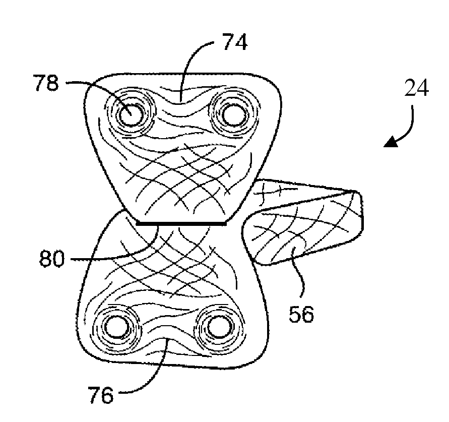 Bioresorbable Spinal Implant and Related Methods