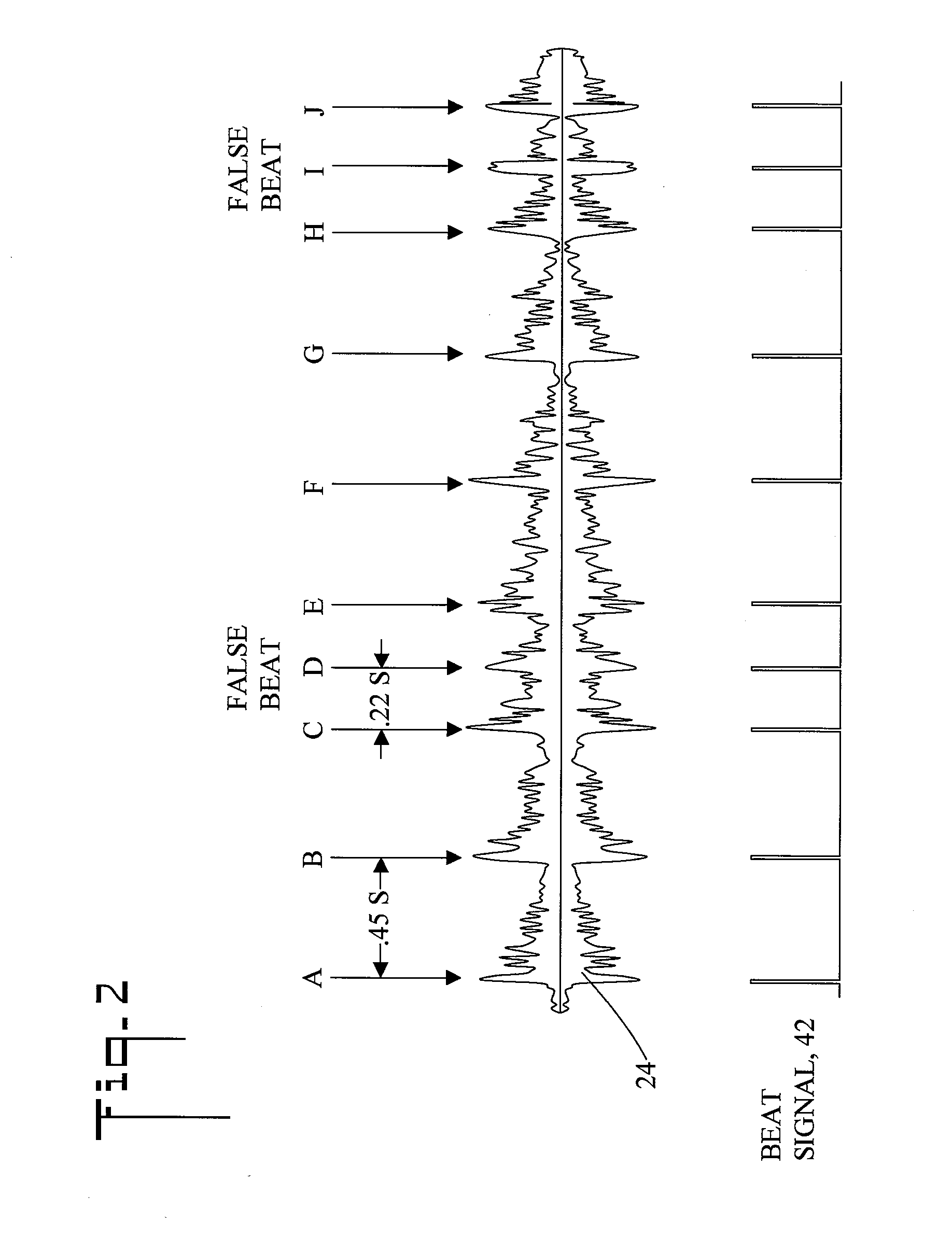 System for calculating the tempo of music