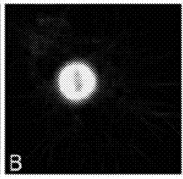 Compositions and Methods employing Wolbachia FtsZ as a target for Albendazole sulfone