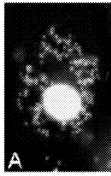 Compositions and Methods employing Wolbachia FtsZ as a target for Albendazole sulfone