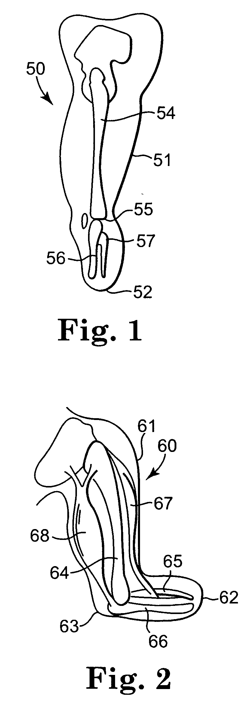 Vacuum pump with shock absorption and controlled rotation for prosthetic devices