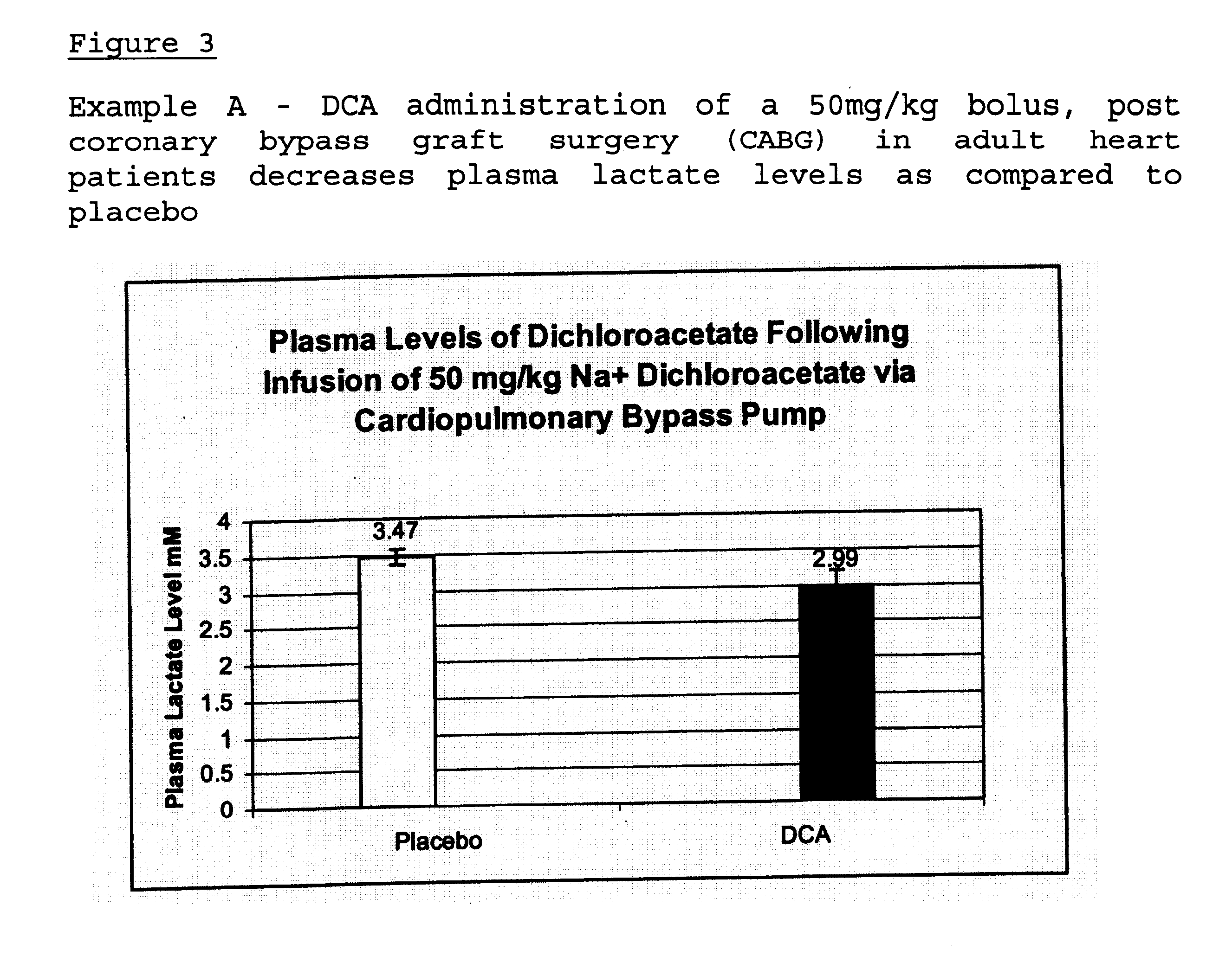 Methods of cardioprotection using dichloroacetate in combination with an inotrope