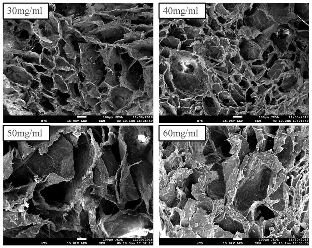 Bone-imitated hydroxyapatite-collagen composite scaffold and preparation method thereof