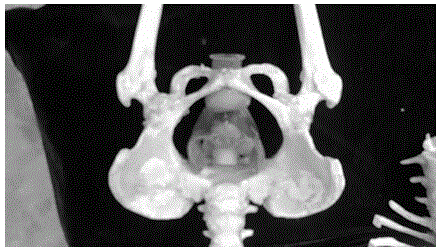 Artificial human skeleton manufacturing method based on radiation detection