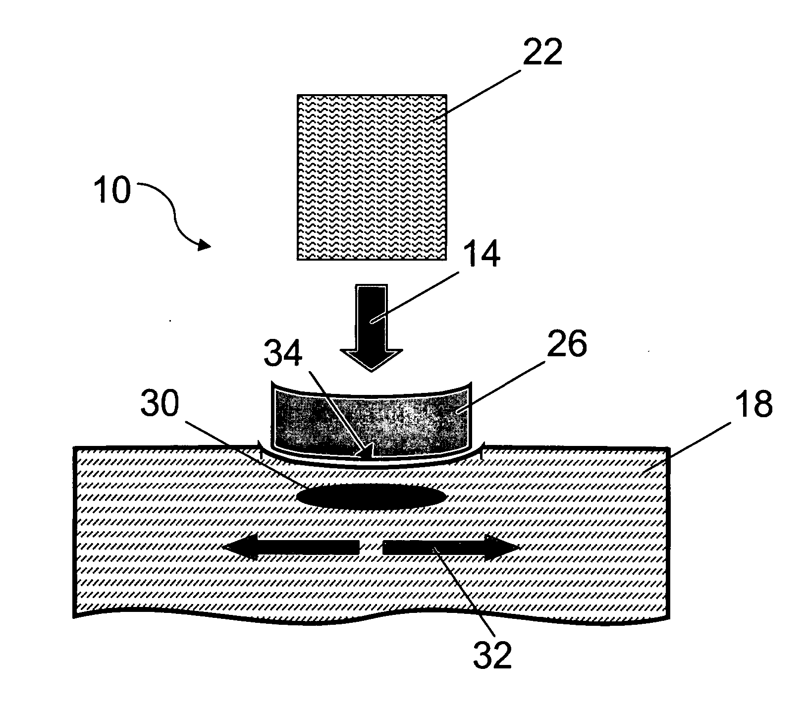 Compression device for a laser handpiece