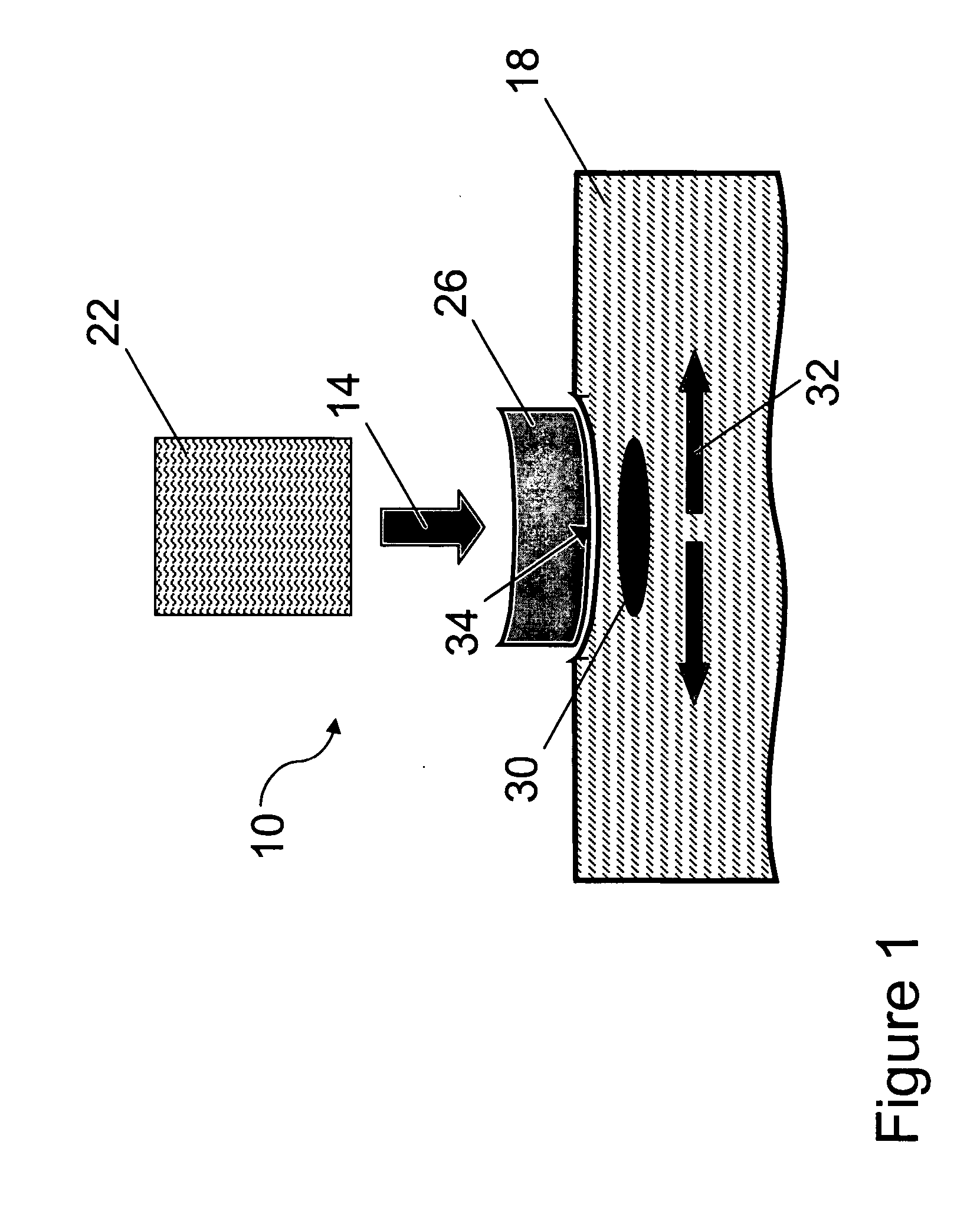 Compression device for a laser handpiece