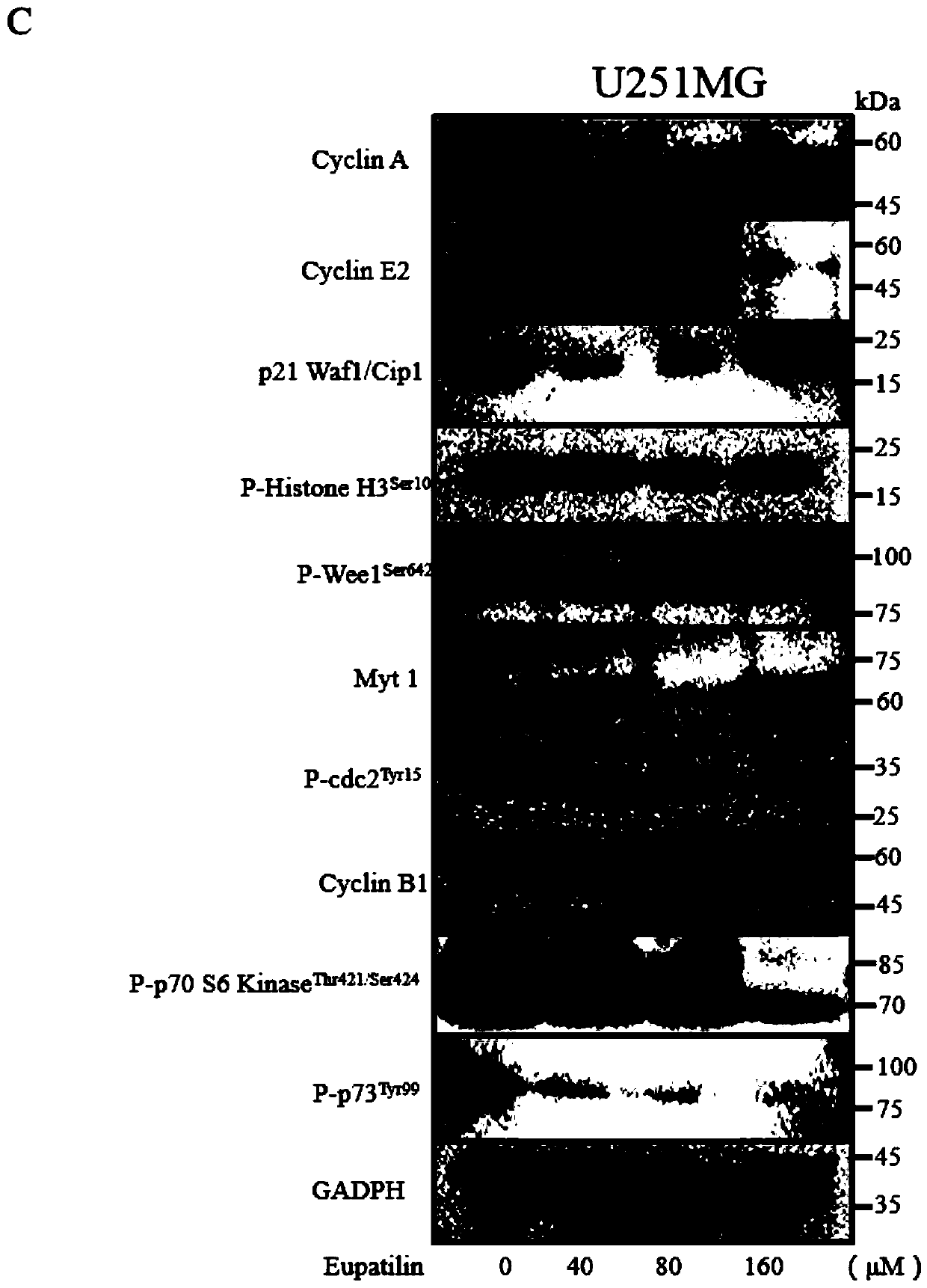 Application of eupatilin in preparing drug for treating or preventing glioma