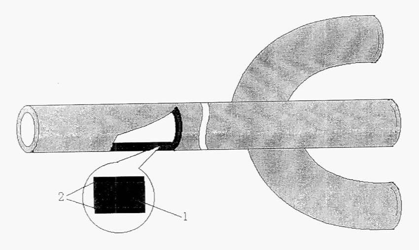 Nanometer antibacterial urinary catheter