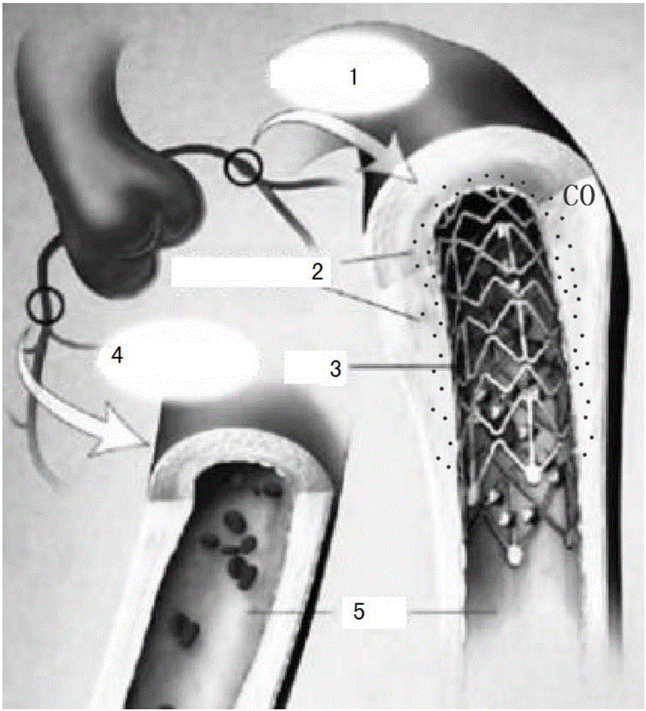 Haem oxygenase drug eluting stent