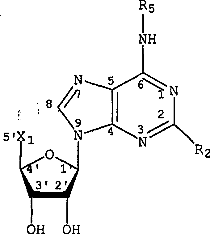 Adenosine a3 receptor agonists for the treatment of dry eye disorders